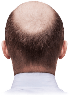 Bald Head PNG