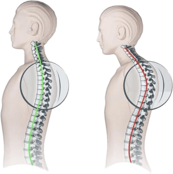 Neck Pain PNG