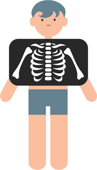 X Ray PNG