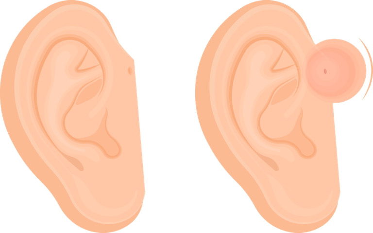 Elf Ear PNG