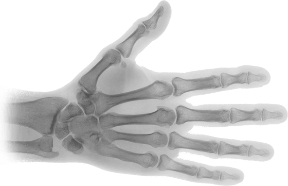 X Ray PNG