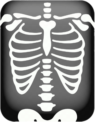 X Ray PNG