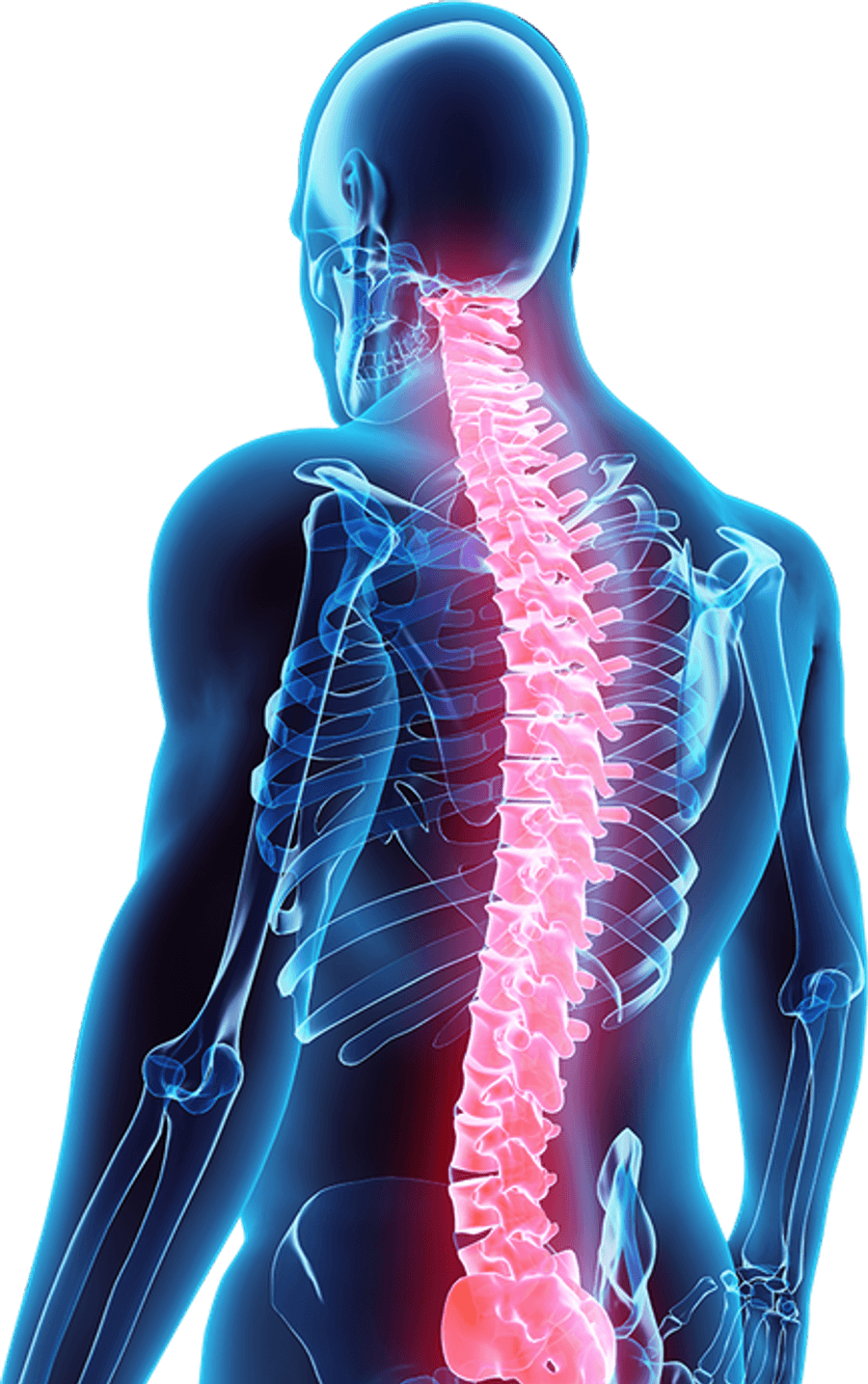 Neck Pain PNG
