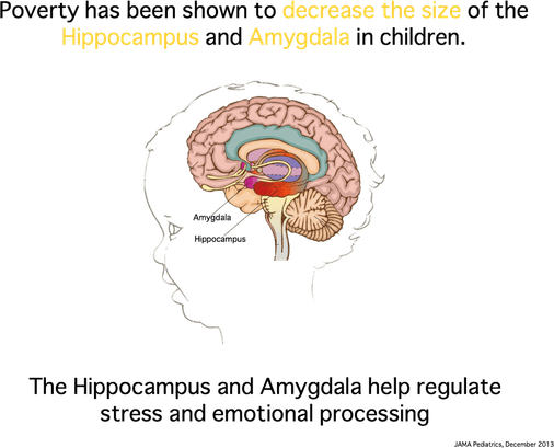 Child Brain PNG