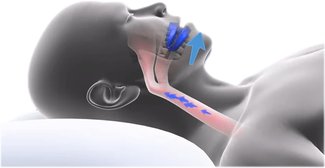 Snoring PNG