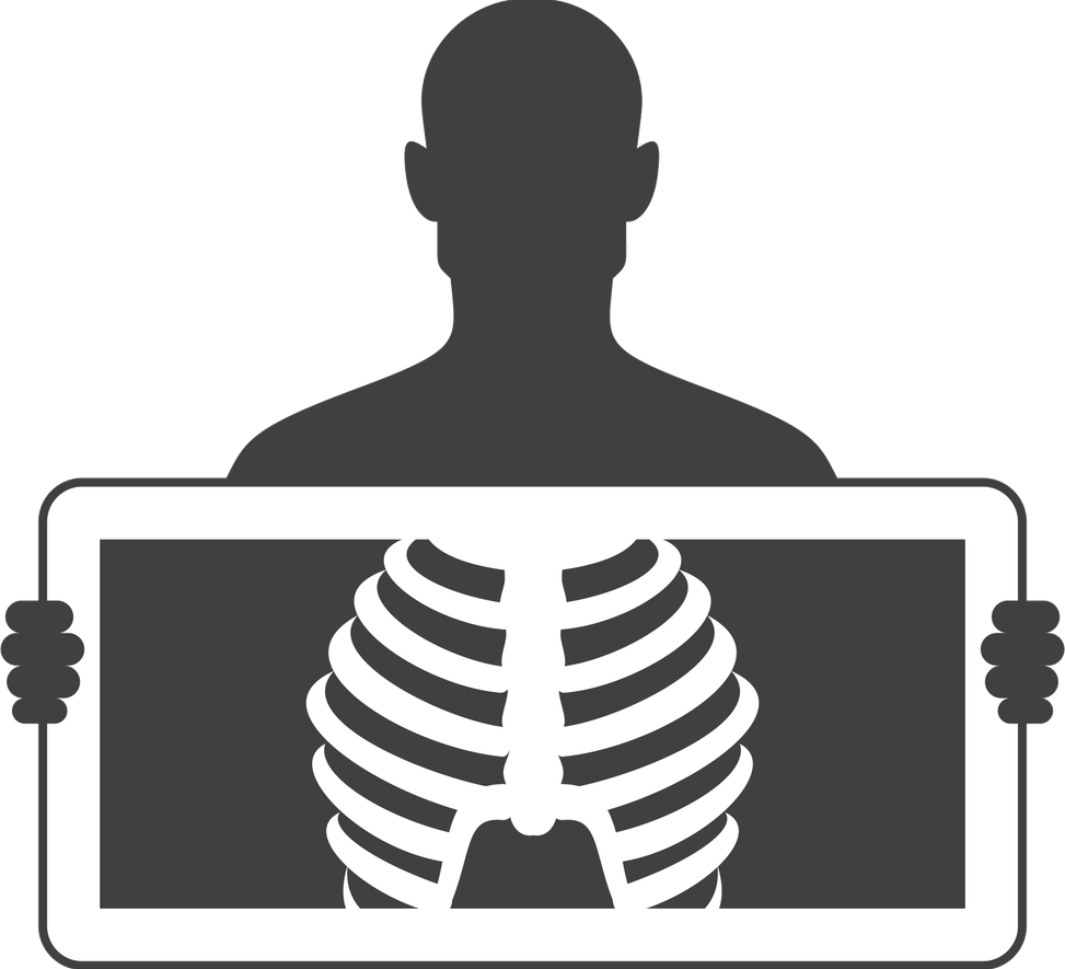 X Ray PNG
