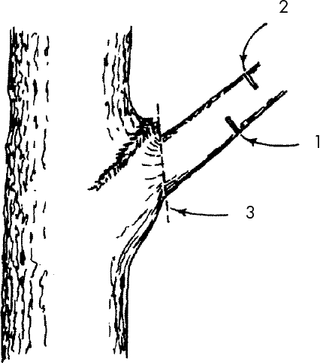 Uprooted Tree PNG