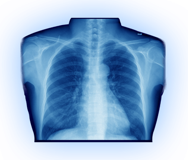 X Ray PNG
