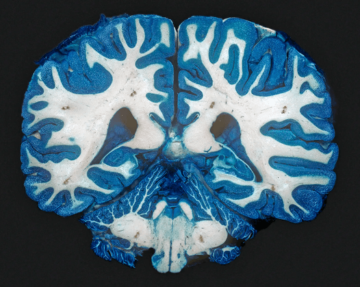 Clear Brain PNG